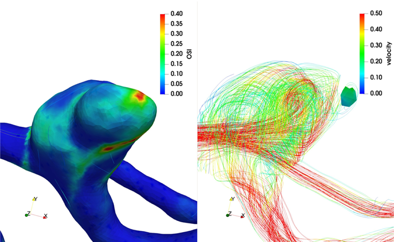 Projekt MEDITECH - Krevní řečiště pod lupou - boj s mozkovými aneuryzmaty