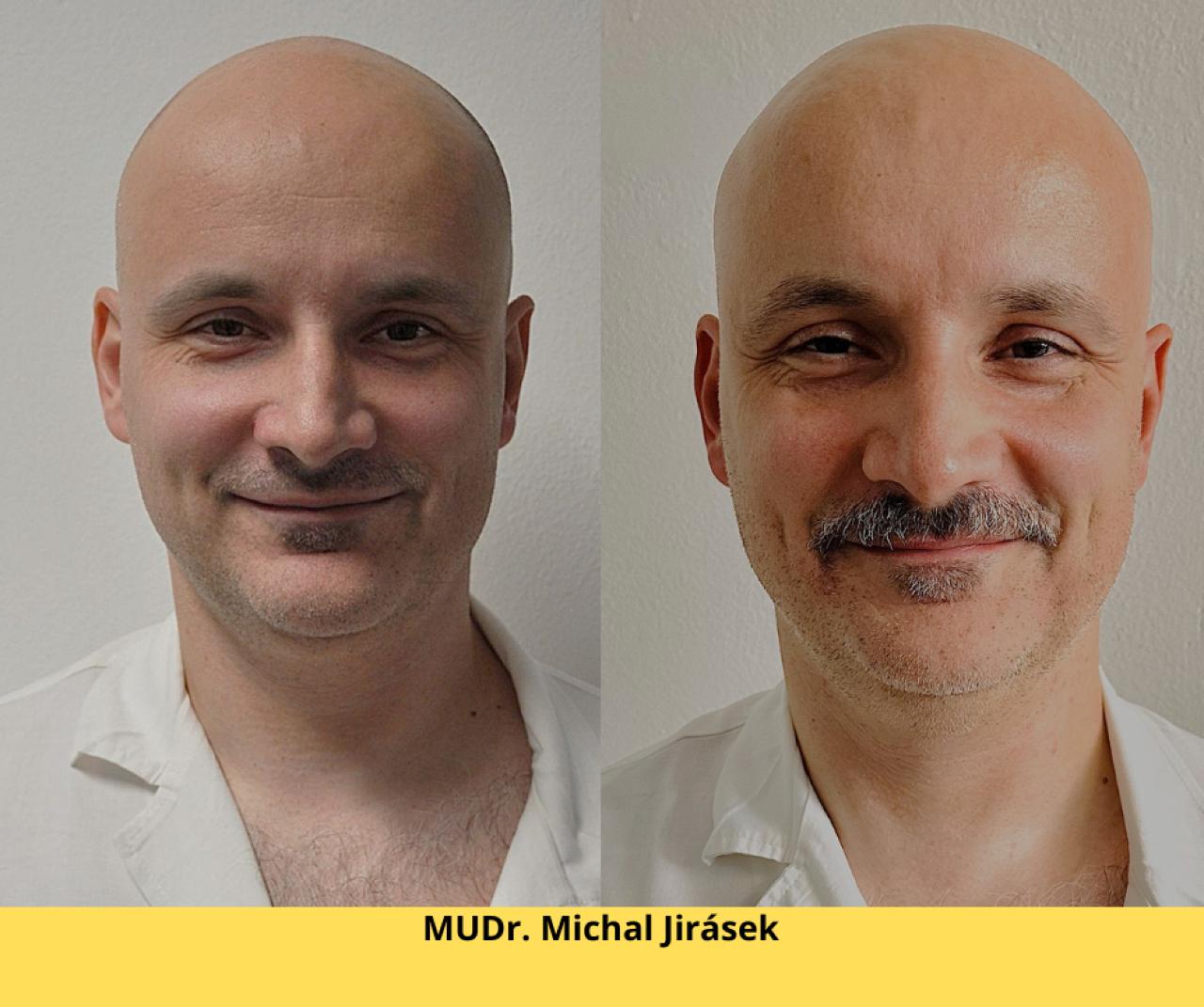 Movember u chirurgů