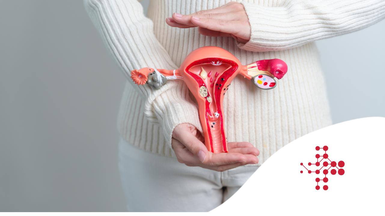 Rakovina vaječníků: hormonální léčba po menopauze zvyšuje její riziko