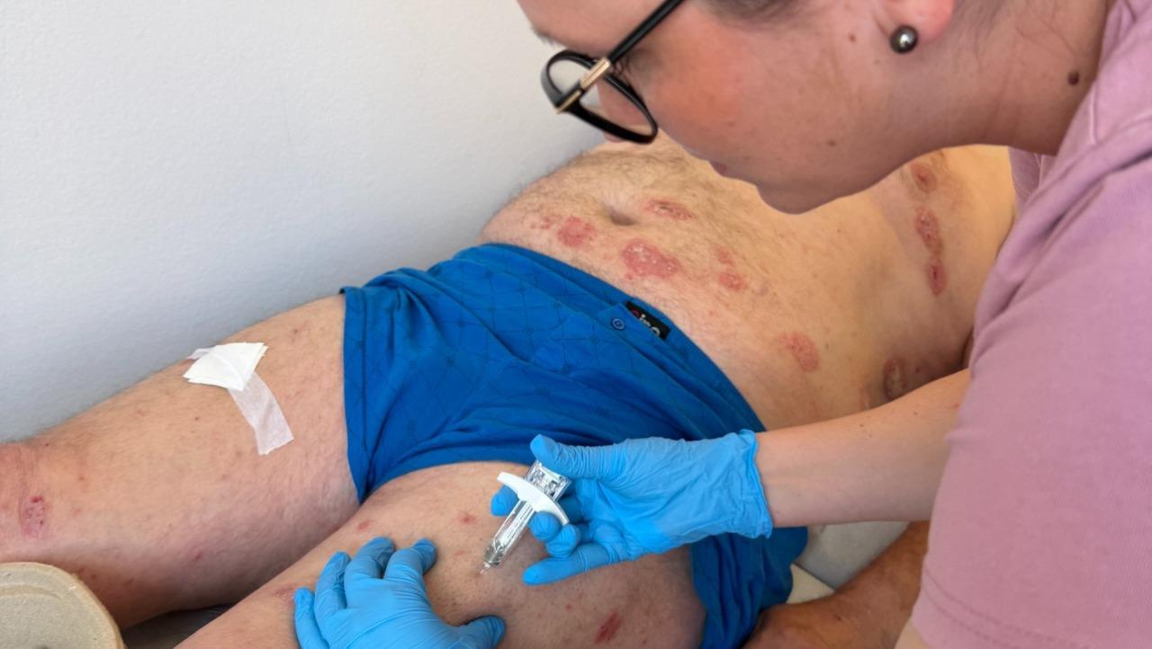 Nemocnice Třebíč rozšiřuje dermatologickou péči o biologickou terapii